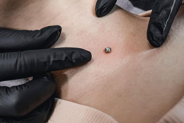 Sterylne założenie mikrodermala — VEAN Jelenia Góra