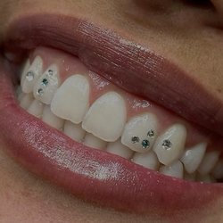 Tooth Gems Piercing