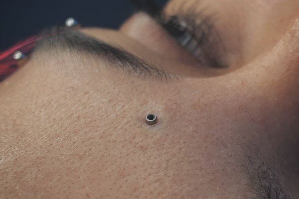 Microdermal na czole, subtelnie osadzony w skórze.