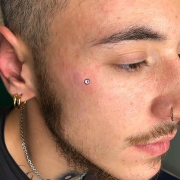 Microdermal pod okiem – punktowa ozdoba twarzy