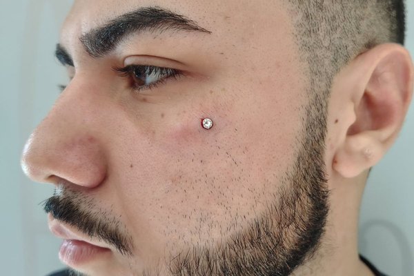 Microdermal pod okiem – pojedynczy kryształek